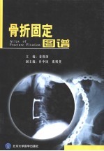 骨折固定图谱