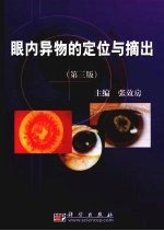 眼内异物的定位与摘出 第3版
