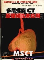 多层螺旋CT原理和临床应用