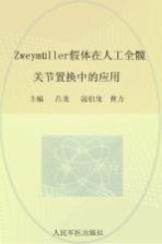 Zweymüller假体在人工全髋关节置换术中的应用