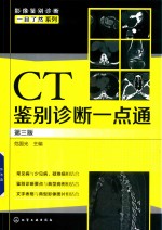 CT鉴别诊断一点通 第3版
