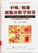 针吸脱落细胞诊断学图谱