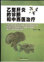 乙型肝炎的诊断和中西医治疗
