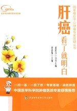 国家癌症中心肿瘤专家答疑丛书 肝癌看了就明白