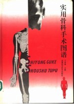 实用骨科手术图谱 下