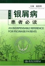 银屑病患者必读
