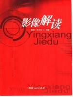 影像解读