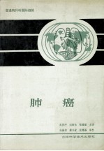 肺癌 第1卷