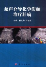 超声介导化学消融治疗肝癌