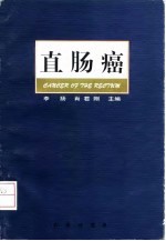 直肠癌
