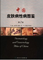 中国皮肤病性病图鉴 第2版