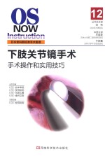 手术操作和实用技巧 12 下肢关节镜手术